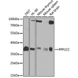 Western Blot - Anti-PP1C gamma Antibody (A14509) - Antibodies.com