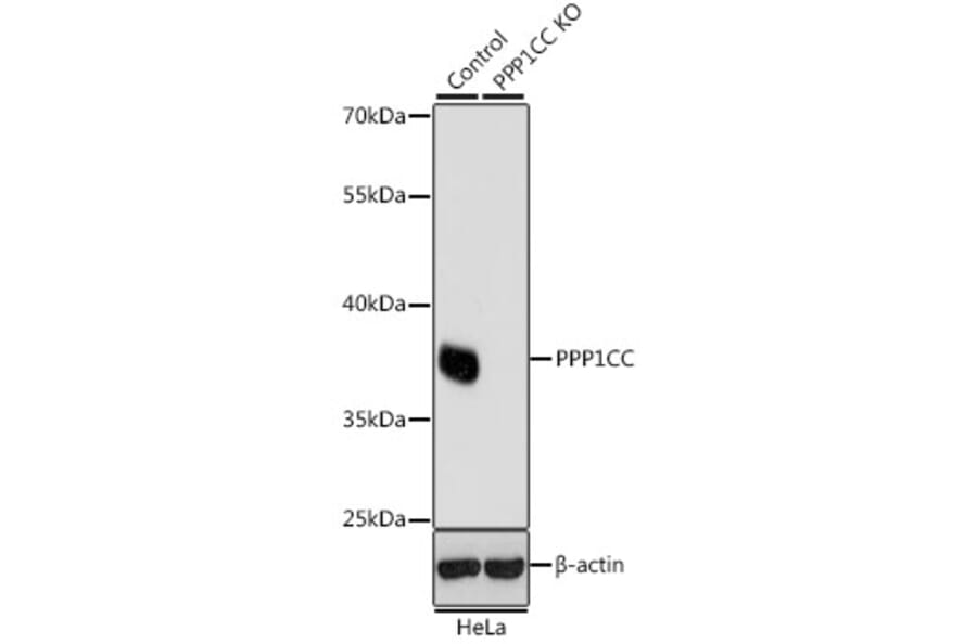 Western Blot - Anti-PP1C gamma Antibody (A14509) - Antibodies.com