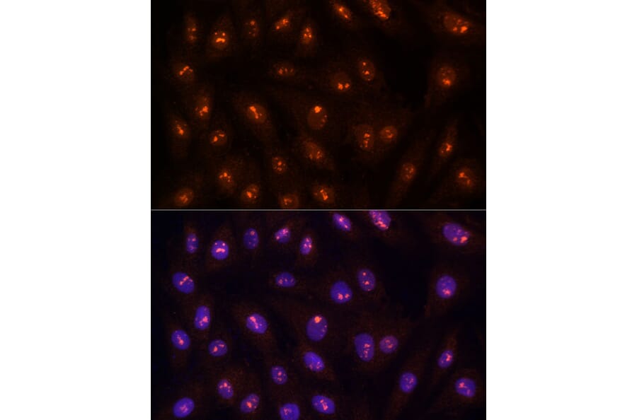 Immunofluorescence - Anti-PP1C gamma Antibody (A14509) - Antibodies.com