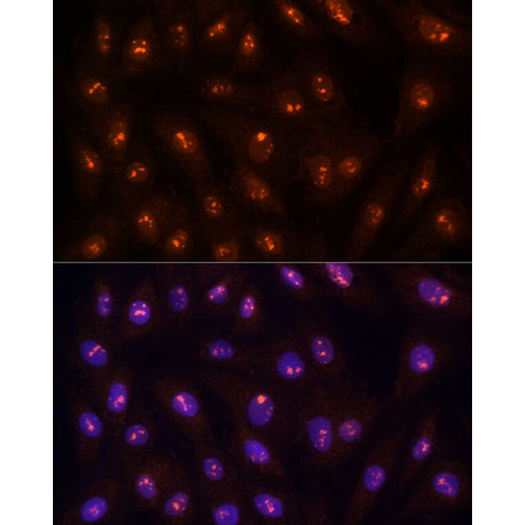 Immunofluorescence - Anti-PP1C gamma Antibody (A14509) - Antibodies.com