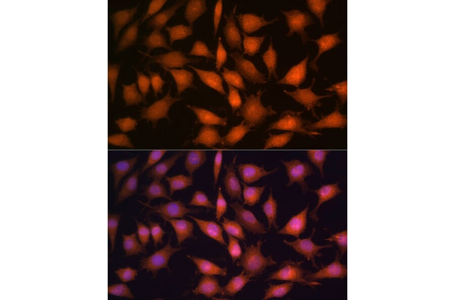 Immunofluorescence - Anti-PP1C gamma Antibody (A14509) - Antibodies.com