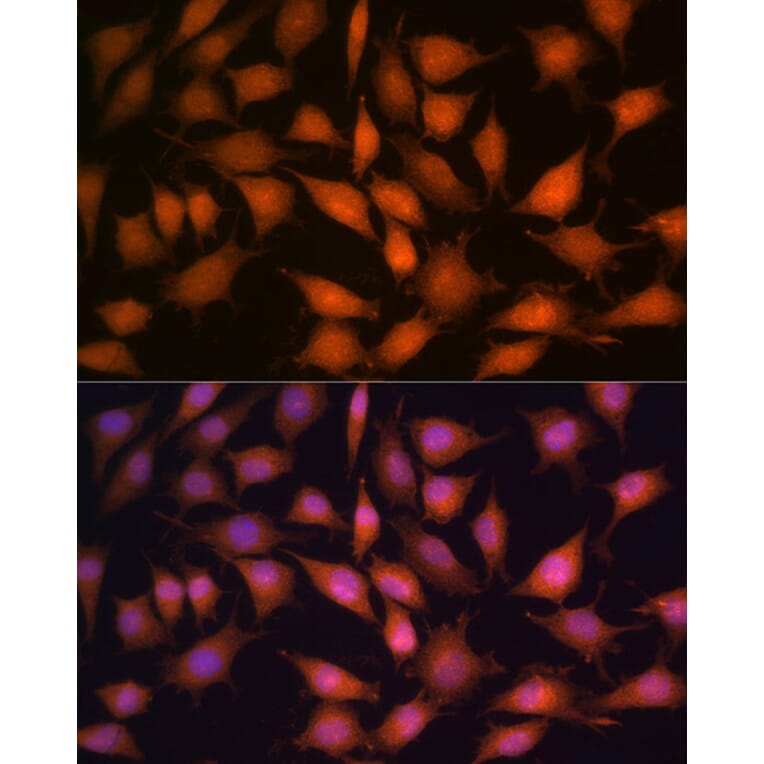 Immunofluorescence - Anti-PP1C gamma Antibody (A14509) - Antibodies.com