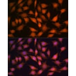 Immunofluorescence - Anti-PP1C gamma Antibody (A14509) - Antibodies.com