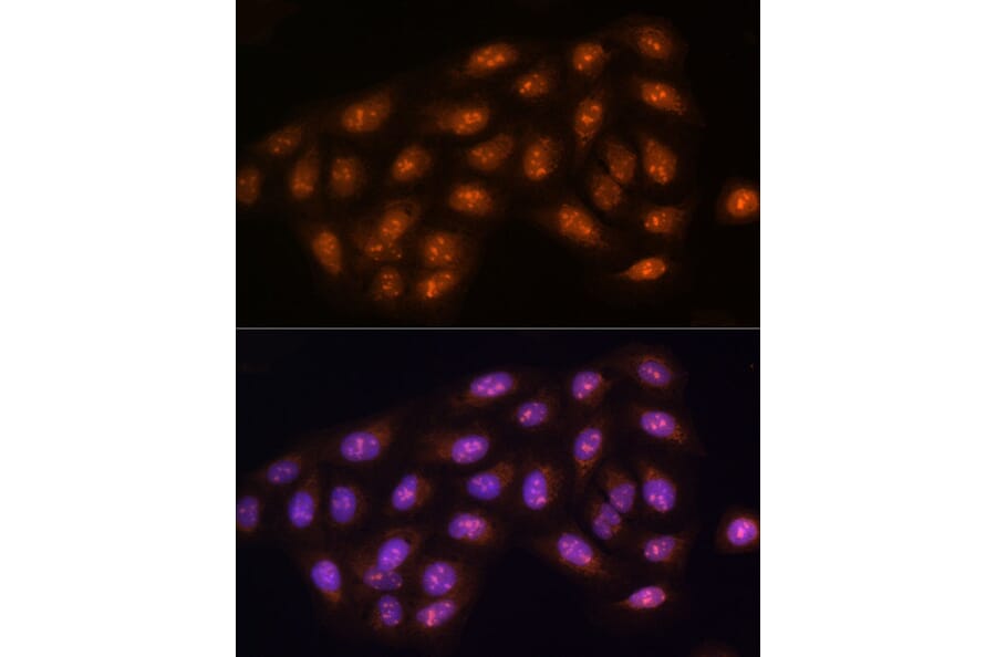 Immunofluorescence - Anti-PP1C gamma Antibody (A14509) - Antibodies.com