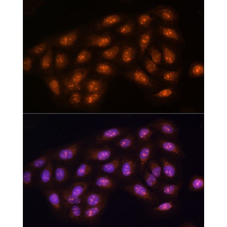 Immunofluorescence - Anti-PP1C gamma Antibody (A14509) - Antibodies.com