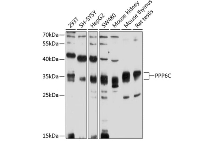 Western Blot - Anti-PPP6C Antibody (A4039) - Antibodies.com