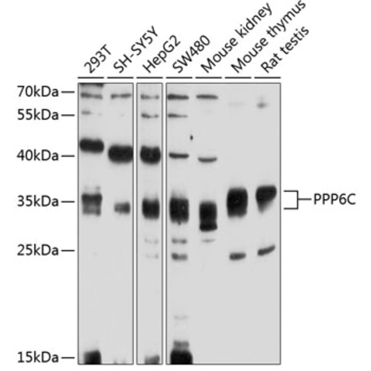 Western Blot - Anti-PPP6C Antibody (A4039) - Antibodies.com