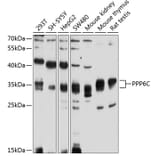 Western Blot - Anti-PPP6C Antibody (A4039) - Antibodies.com