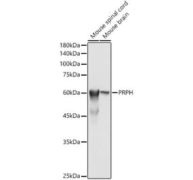 Western Blot - Anti-Peripherin Antibody (A14511) - Antibodies.com