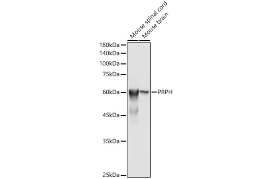 Western Blot - Anti-Peripherin Antibody (A14511) - Antibodies.com
