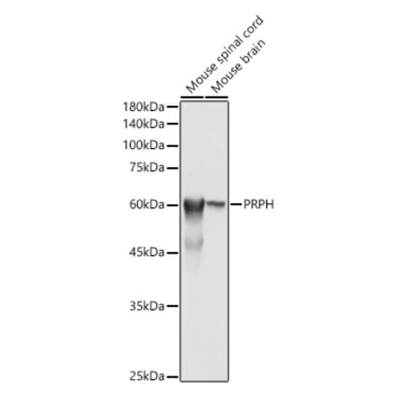 Western Blot - Anti-Peripherin Antibody (A14511) - Antibodies.com