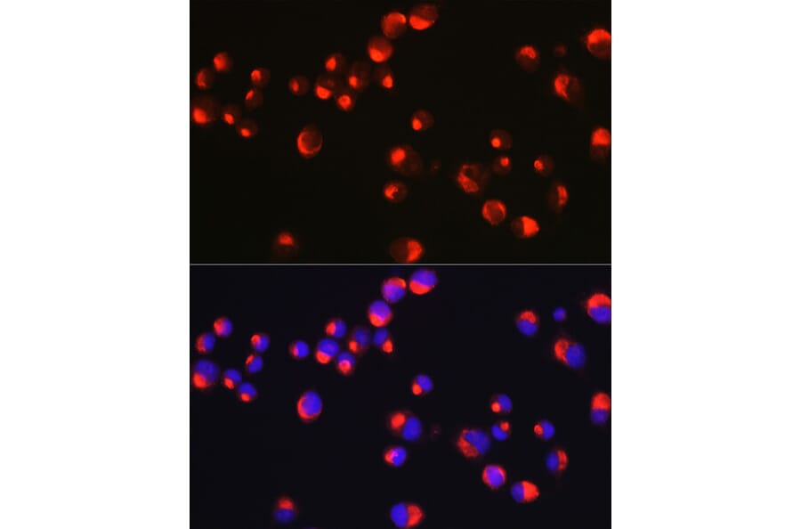 Immunofluorescence - Anti-Peripherin Antibody (A14511) - Antibodies.com