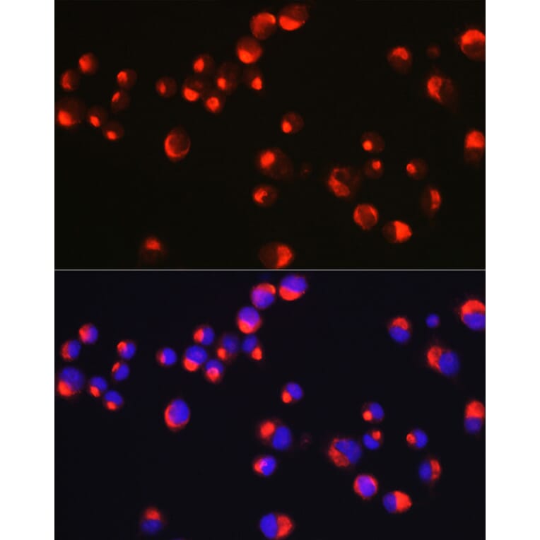 Immunofluorescence - Anti-Peripherin Antibody (A14511) - Antibodies.com