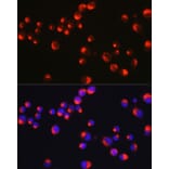 Immunofluorescence - Anti-Peripherin Antibody (A14511) - Antibodies.com