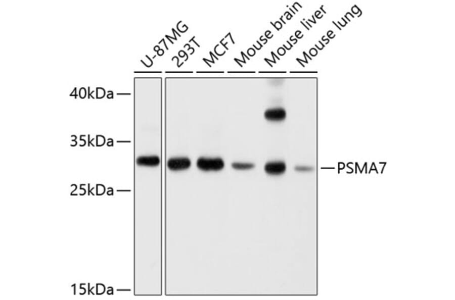 Western Blot - Anti-PSMA7/HSPC Antibody (A14512) - Antibodies.com