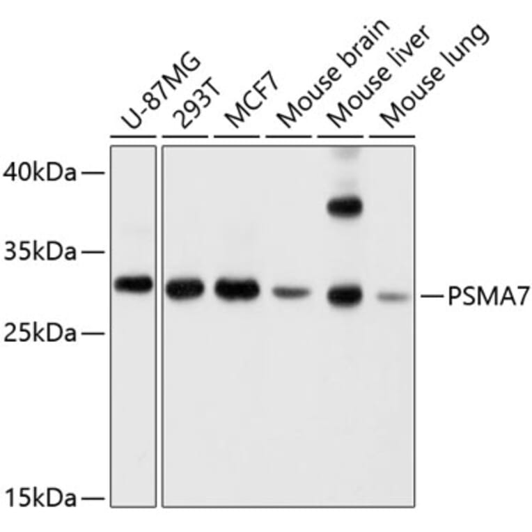 Western Blot - Anti-PSMA7/HSPC Antibody (A14512) - Antibodies.com