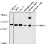 Western Blot - Anti-PSMA7/HSPC Antibody (A14512) - Antibodies.com