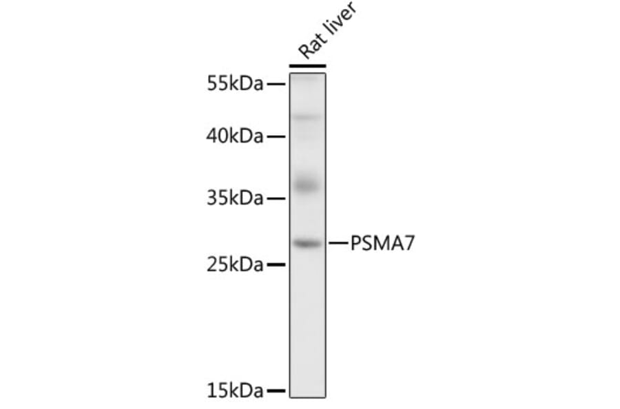 Western Blot - Anti-PSMA7/HSPC Antibody (A14512) - Antibodies.com