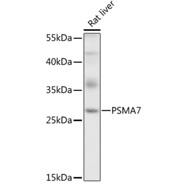 Western Blot - Anti-PSMA7/HSPC Antibody (A14512) - Antibodies.com