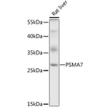 Western Blot - Anti-PSMA7/HSPC Antibody (A14512) - Antibodies.com