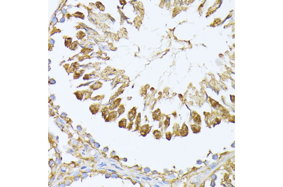 Immunohistochemistry - Anti-PSMA7/HSPC Antibody (A14512) - Antibodies.com