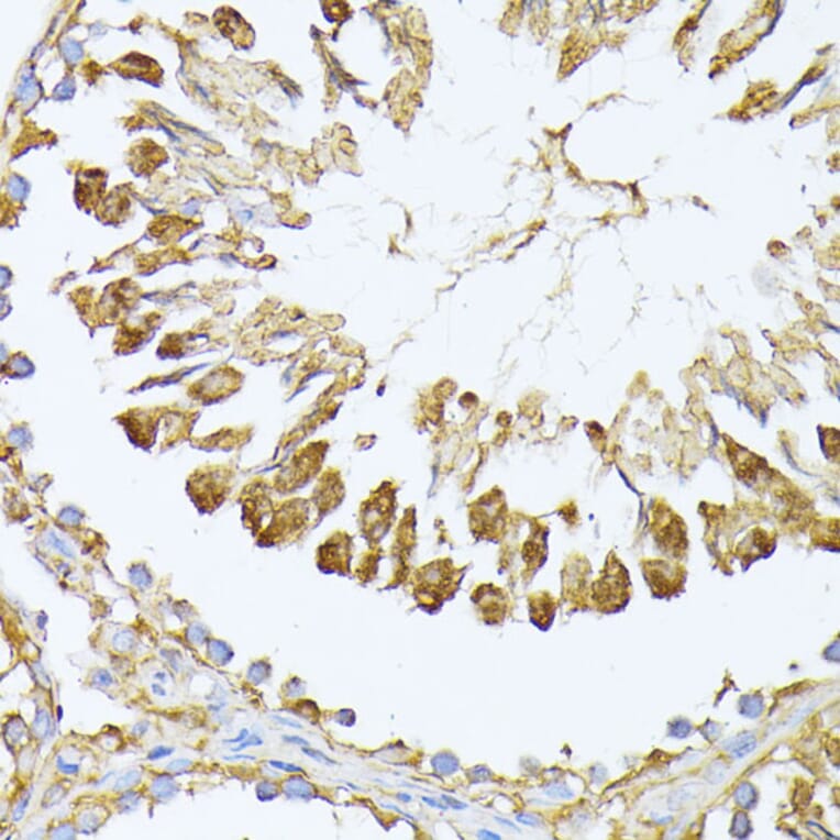 Immunohistochemistry - Anti-PSMA7/HSPC Antibody (A14512) - Antibodies.com