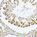 Immunohistochemistry - Anti-PSMA7/HSPC Antibody (A14512) - Antibodies.com