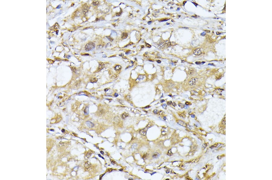 Immunohistochemistry - Anti-PSMA7/HSPC Antibody (A14512) - Antibodies.com