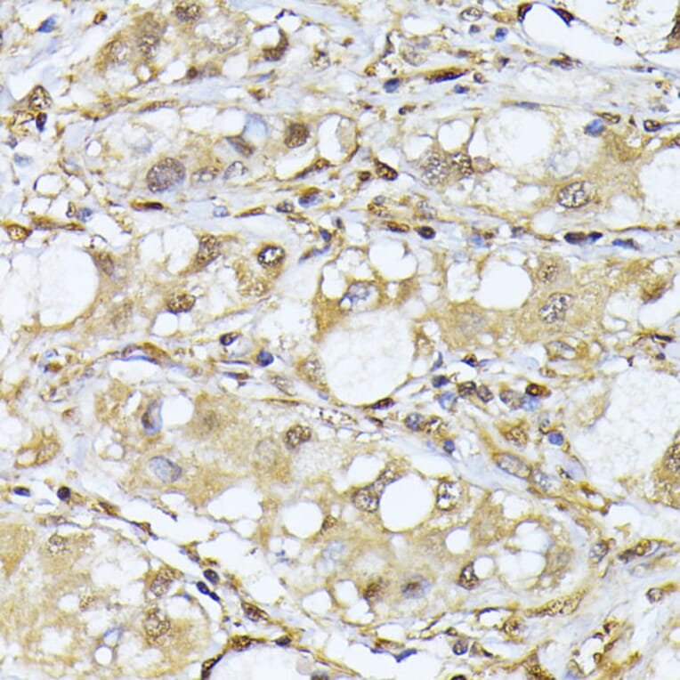 Immunohistochemistry - Anti-PSMA7/HSPC Antibody (A14512) - Antibodies.com