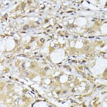 Immunohistochemistry - Anti-PSMA7/HSPC Antibody (A14512) - Antibodies.com