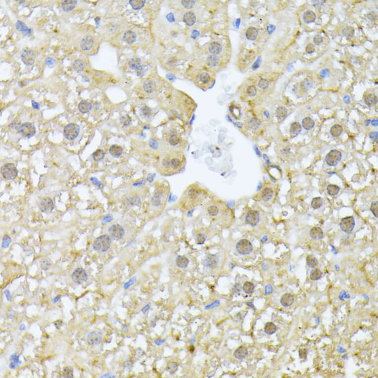 Immunohistochemistry - Anti-PSMA7/HSPC Antibody (A14512) - Antibodies.com