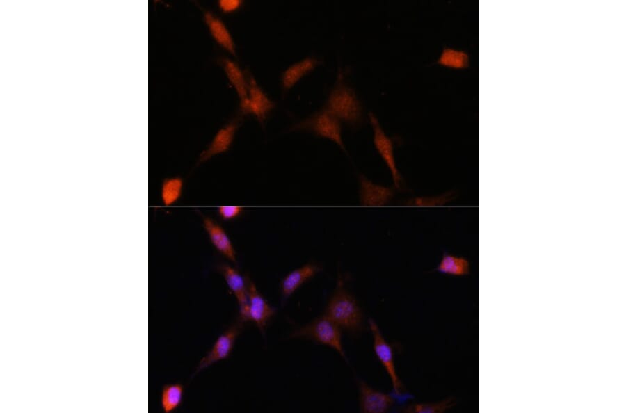 Immunofluorescence - Anti-PSMA7/HSPC Antibody (A14512) - Antibodies.com