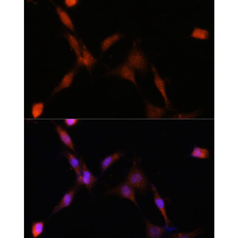 Immunofluorescence - Anti-PSMA7/HSPC Antibody (A14512) - Antibodies.com