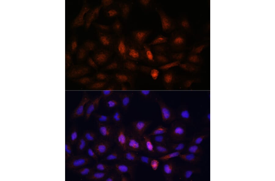 Immunofluorescence - Anti-PSMA7/HSPC Antibody (A14512) - Antibodies.com