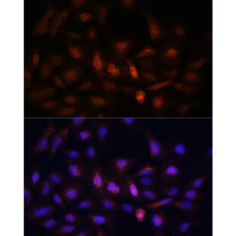 Immunofluorescence - Anti-PSMA7/HSPC Antibody (A14512) - Antibodies.com