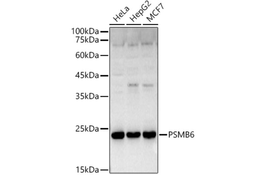Western Blot - Anti-Proteasome 20S beta 6 Antibody (A14513) - Antibodies.com