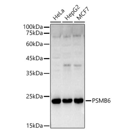 Western Blot - Anti-Proteasome 20S beta 6 Antibody (A14513) - Antibodies.com