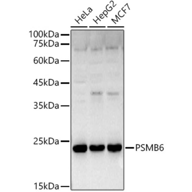 Western Blot - Anti-Proteasome 20S beta 6 Antibody (A14513) - Antibodies.com