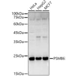 Western Blot - Anti-Proteasome 20S beta 6 Antibody (A14513) - Antibodies.com