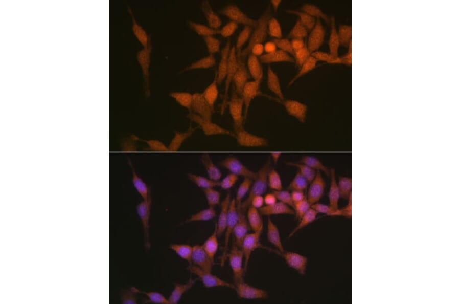Immunofluorescence - Anti-Proteasome 20S beta 6 Antibody (A14513) - Antibodies.com