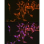 Immunofluorescence - Anti-Proteasome 20S beta 6 Antibody (A14513) - Antibodies.com