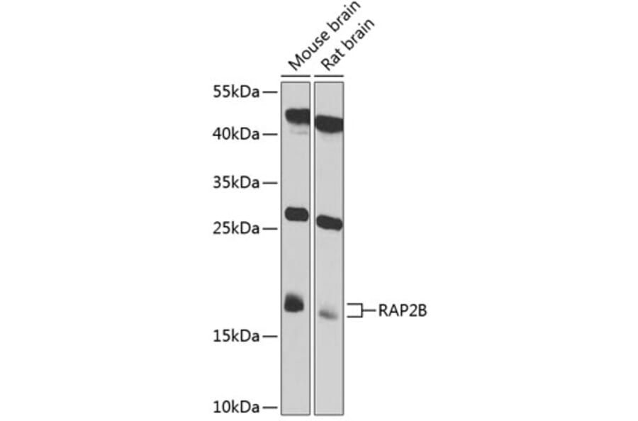 Western Blot - Anti-RAP2B Antibody (A4071) - Antibodies.com