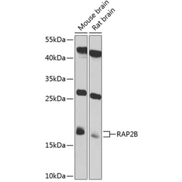 Western Blot - Anti-RAP2B Antibody (A4071) - Antibodies.com