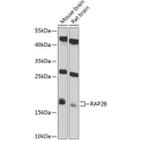 Western Blot - Anti-RAP2B Antibody (A4071) - Antibodies.com