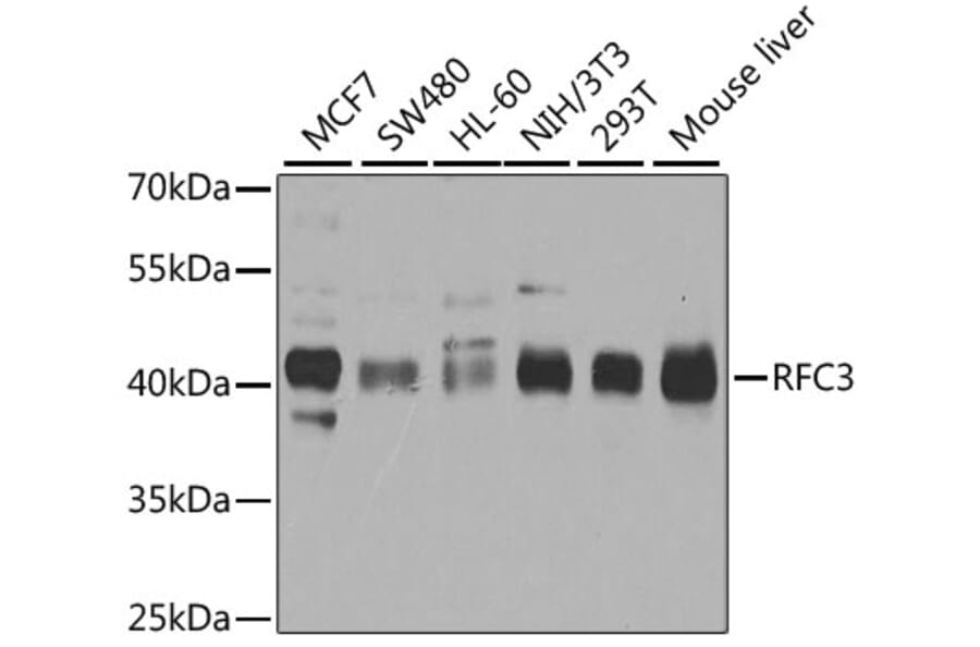 Western Blot - Anti-RFC3 Antibody (A14515) - Antibodies.com