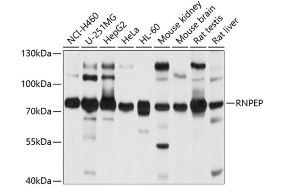 Western Blot - Anti-RNPEP Antibody (A4080) - Antibodies.com