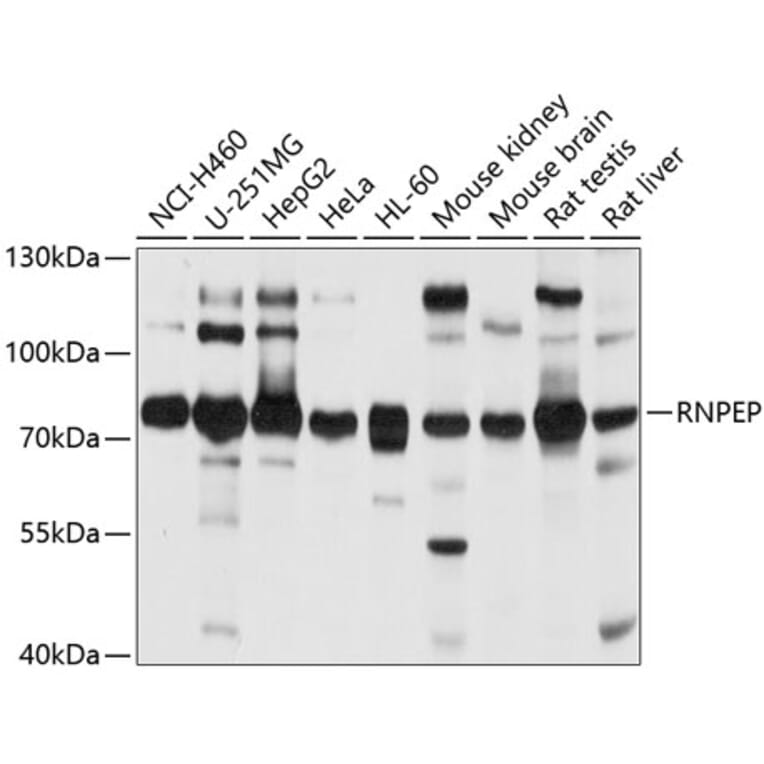 Western Blot - Anti-RNPEP Antibody (A4080) - Antibodies.com