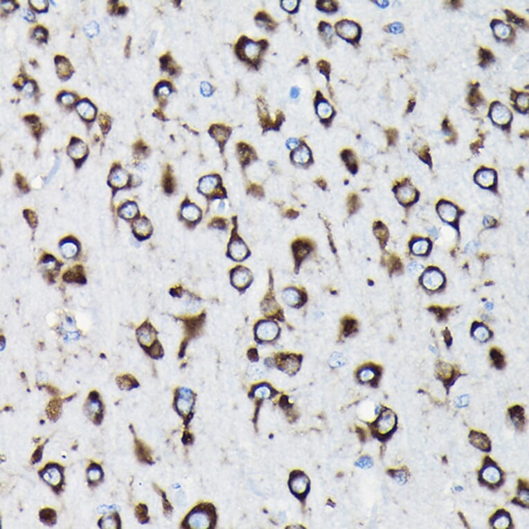 Immunohistochemistry - Anti-RPL23A Antibody (A14518) - Antibodies.com