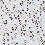 Immunohistochemistry - Anti-RPL23A Antibody (A14518) - Antibodies.com