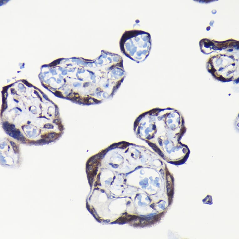 Immunohistochemistry - Anti-RPL23A Antibody (A14518) - Antibodies.com